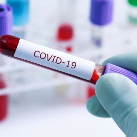Рейтинг країн за кількістю хворих на COVID-19 на 100 тис. населення